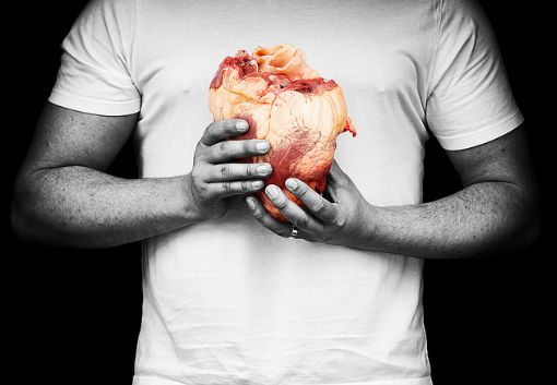 сердце сердечно-сосудистые заболевания инфаркт